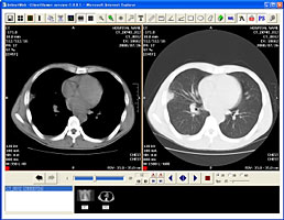 DICOM画像Web配信サーバシステム ビューワ