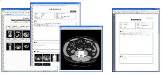 DICOM画像Web配信サーバシステム レポート 電子カルテ