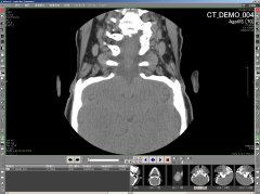 マルチモダリティ医療用画像ビューワ シネモード再生
