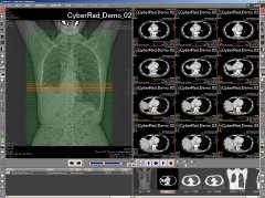 マルチモダリティ医療用画像ビューワ リファレンスライン