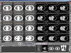 マルチモダリティ医療用画像ビューワ 初期設定値反映